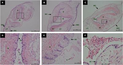 Histological and Comparative Transcriptome Analyses Provide Insights Into the Immune Response in Pearl Sac Formation of Hyriopsis cumingii